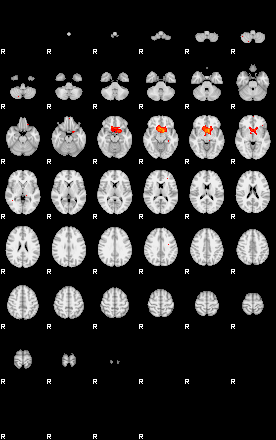 Patients 29066 27