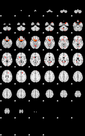 Patients 29070 170