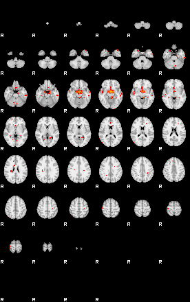 Patients 29154 44