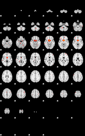 Patients 29162 30