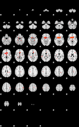 Patients 29169 105