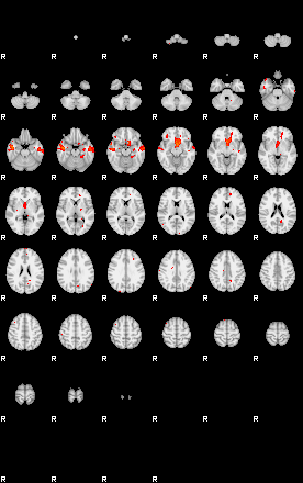 Patients 29186 3