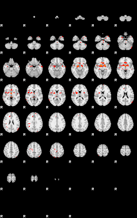 Patients 29514 87