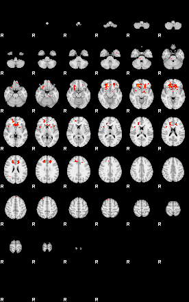 Patients 29515 164