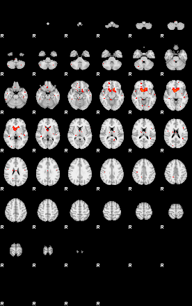 Patients 29522 93