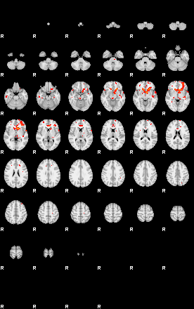 Patients 29671 171