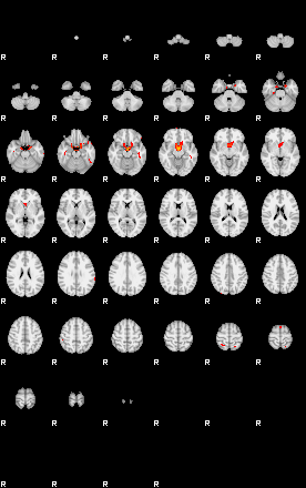 Patients 29741 41