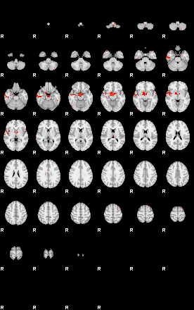 Patients 30002 90