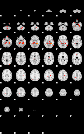 Patients 28771 90