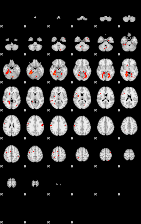 Patients 28789 93