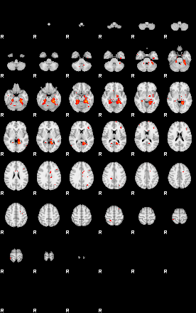 Patients 28820 124