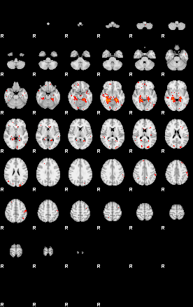 Patients 28920 113