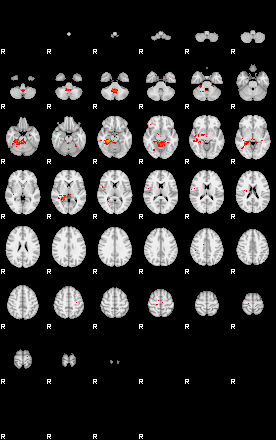 Patients 28962 90