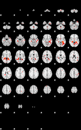 Patients 29013 96