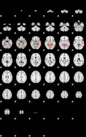 Patients 29042 173