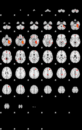 Patients 29070 180