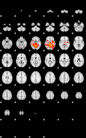 Patients 29110 178