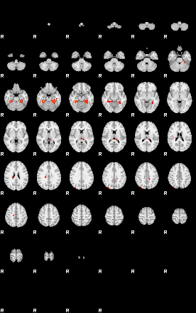 Patients 29151 2