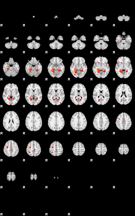 Patients 29161 81