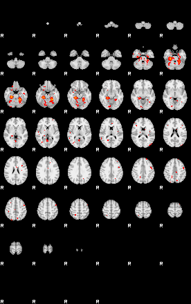 Patients 29170 130