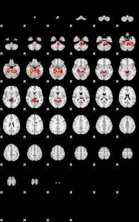 Patients 29182 83