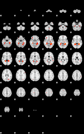 Patients 29186 163