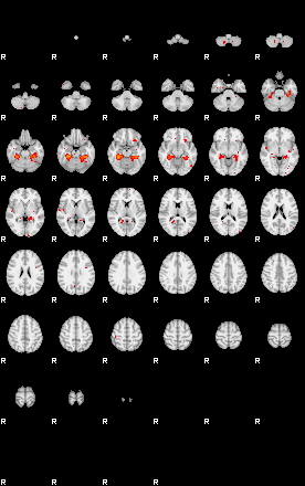 Patients 29189 90