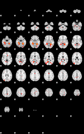 Patients 29190 131