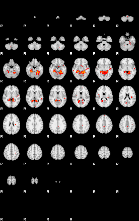 Patients 29215 106