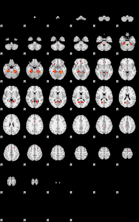 Patients 29216 91