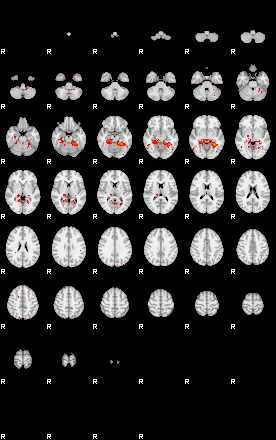 Patients 29220 115