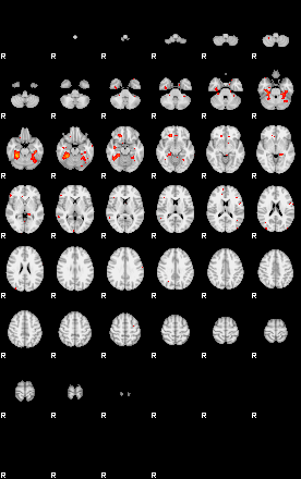 Patients 29221 91