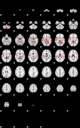 Patients 29279 52