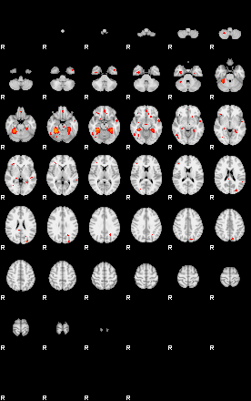 Patients 29281 108