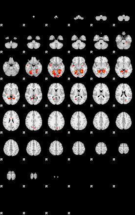 Patients 29281 79