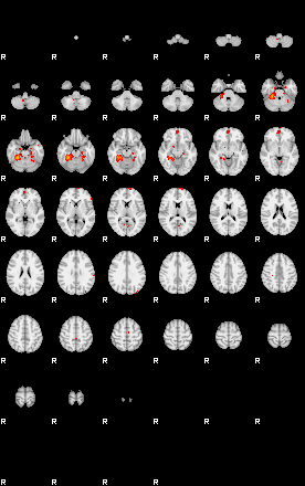 Patients 29283 193