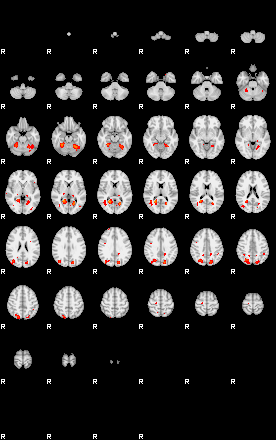 Patients 29290 2