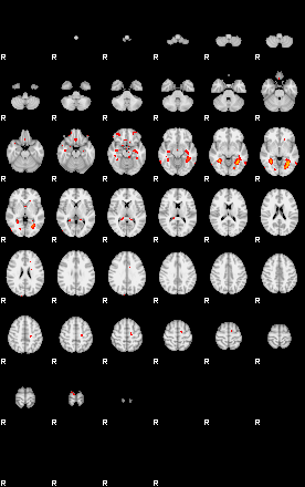 Patients 29393 5