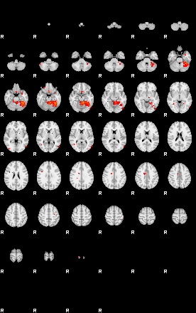 Patients 29394 135