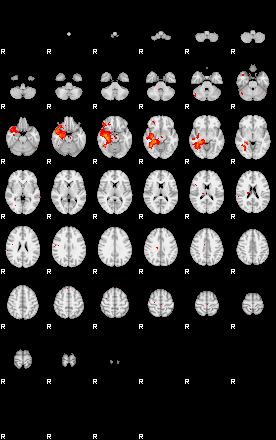 Patients 29413 136