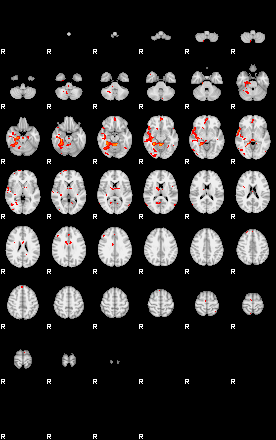 Patients 29417 99