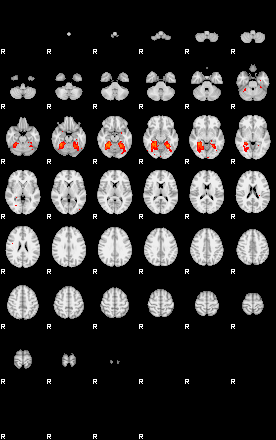 Patients 29435 99