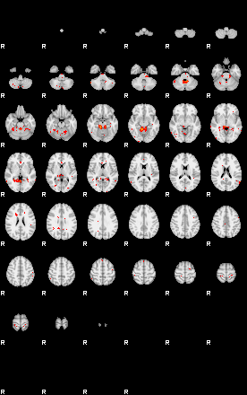 Patients 29591 99