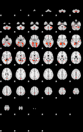 Patients 29626 125