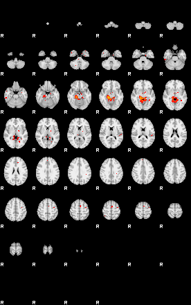 Patients 29656 11