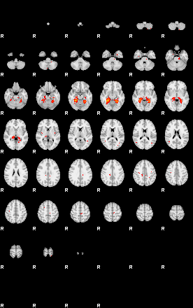 Patients 30003 40