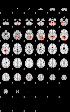 Patients 30017 176