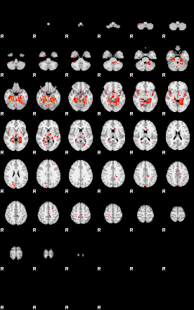 Patients 30180 28