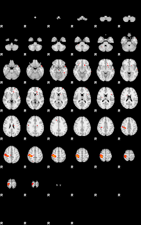 Patients 29278 198