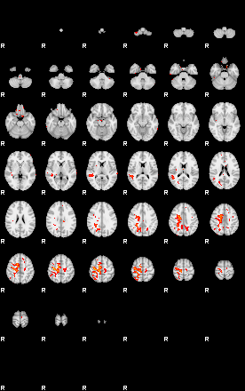 Patients 29433 123